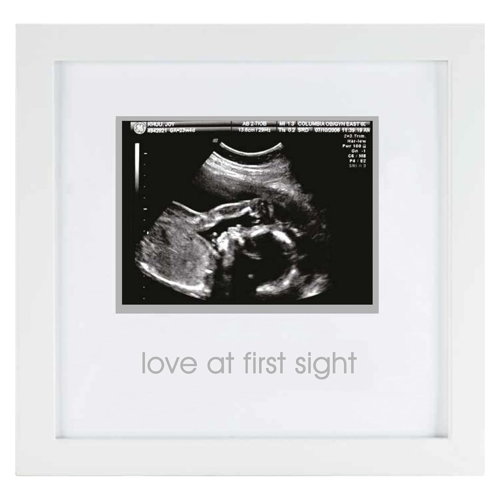 Love at First Sight Sonogram Picture Frame, Gender Neutral Ultrasound Keepsake, Ideal Pregnancy Gift, Baby Shower and Nursery Decor, 4”X3” Photo Insert, White