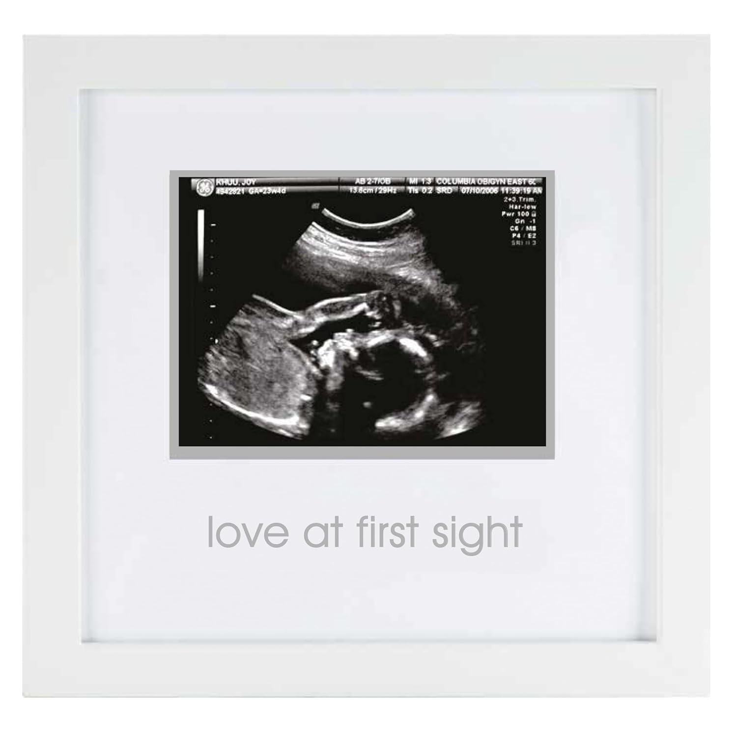 Love at First Sight Sonogram Picture Frame, Gender Neutral Ultrasound Keepsake, Ideal Pregnancy Gift, Baby Shower and Nursery Decor, 4”X3” Photo Insert, White