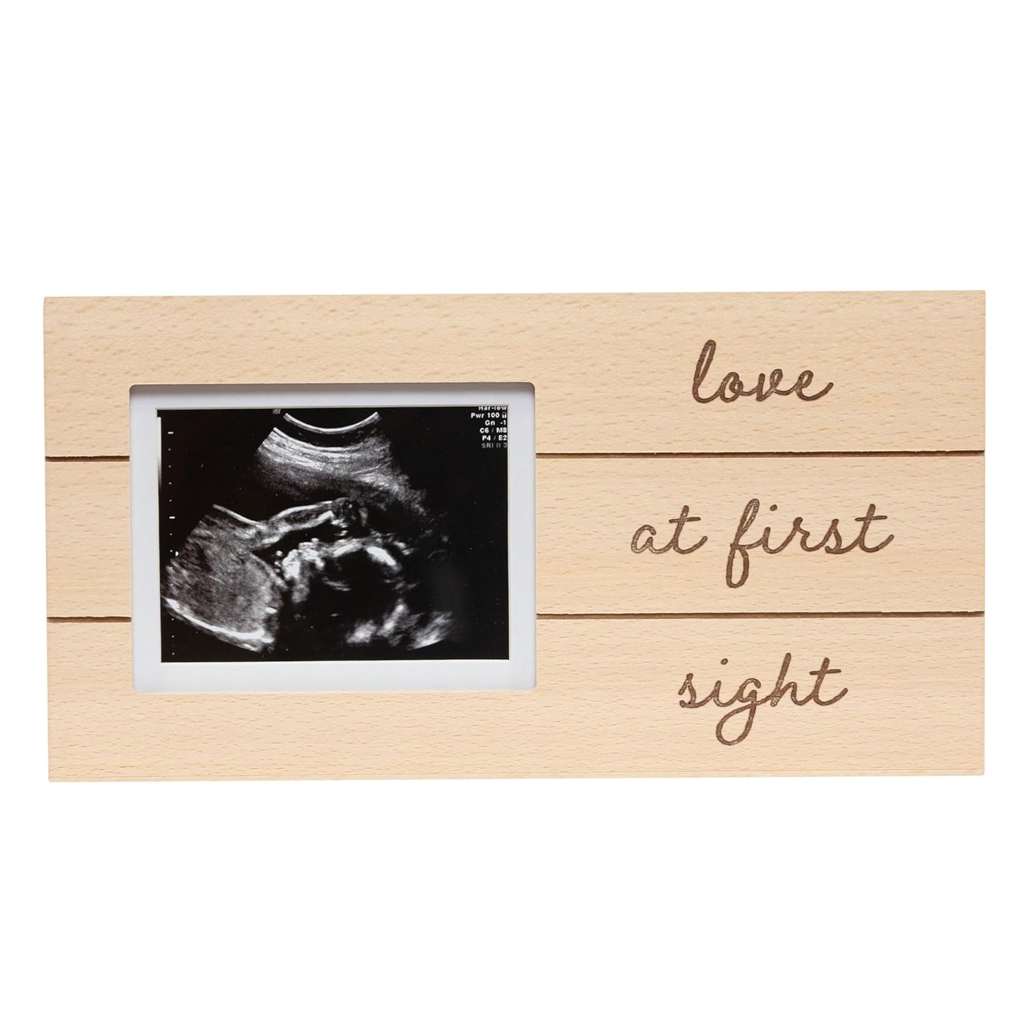 Love at First Sight Sonogram Picture Frame, Gender Neutral Ultrasound Keepsake, Ideal Pregnancy Gift, Baby Shower and Nursery Decor, 4”X3” Photo Insert, White
