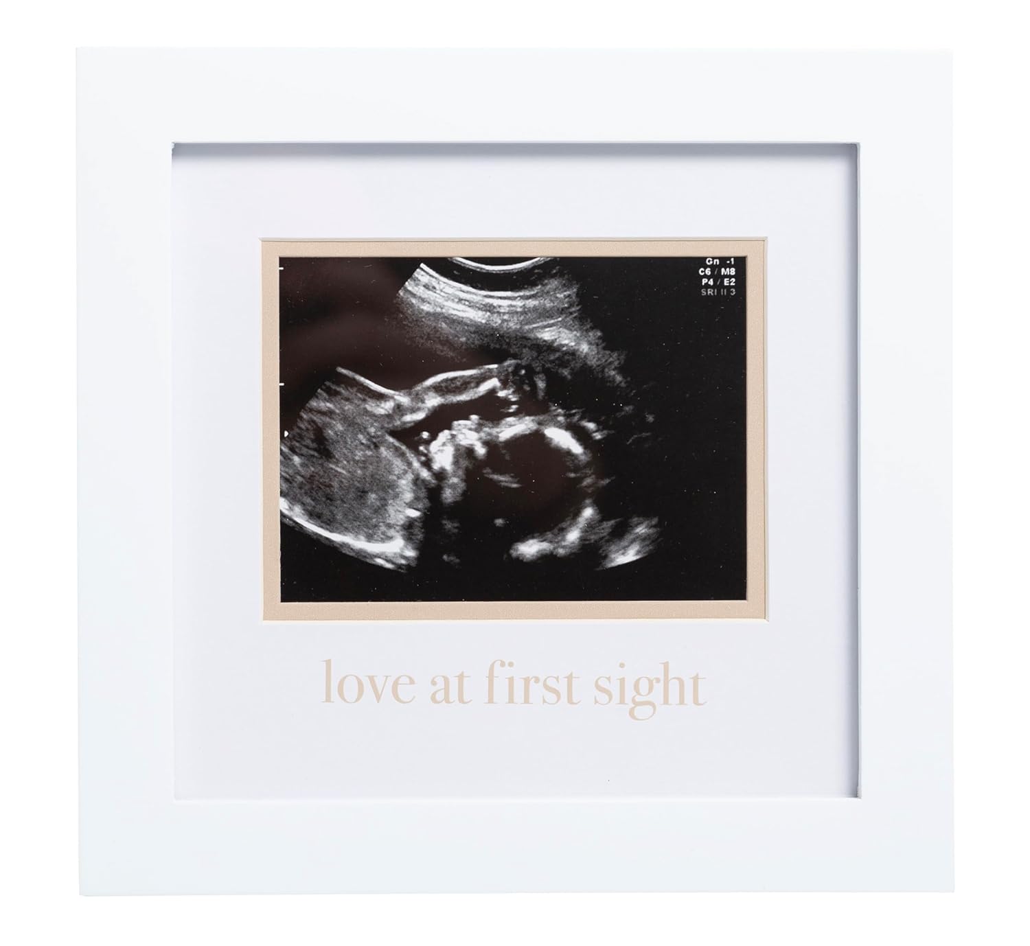 Love at First Sight Sonogram Picture Frame, Gender Neutral Ultrasound Keepsake, Ideal Pregnancy Gift, Baby Shower and Nursery Decor, 4”X3” Photo Insert, White